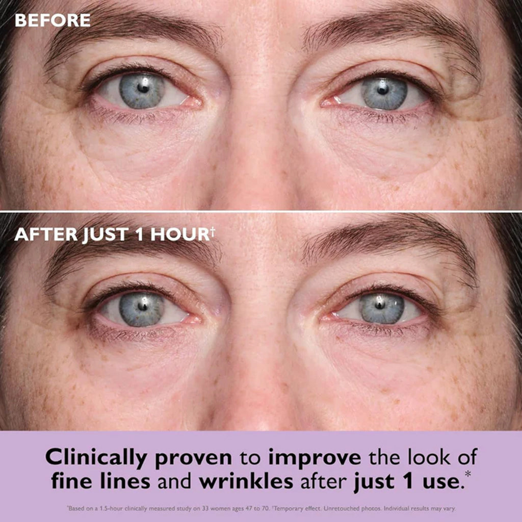 Collagen-Infused Tightening Eye Patches